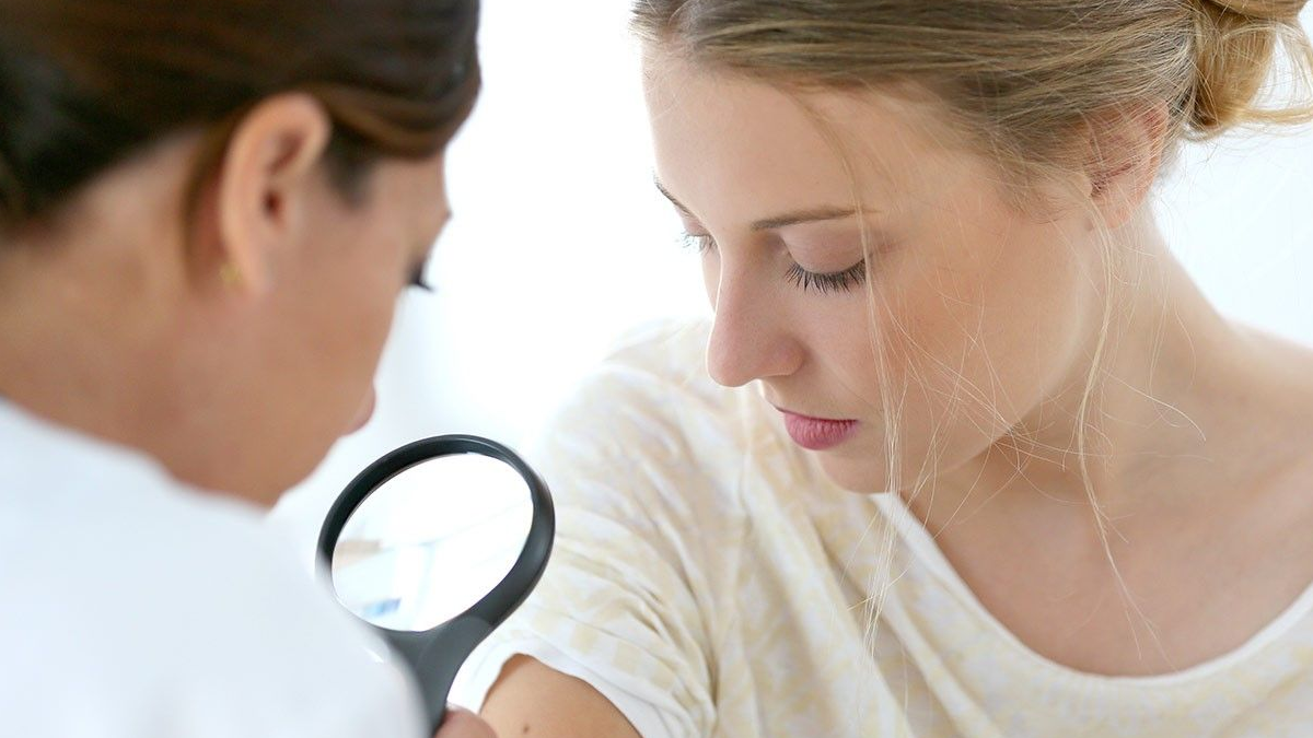 10 Best CBD Acne Treatment Tips